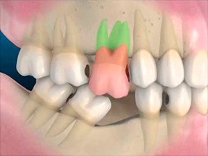 Orthodental