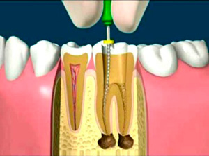 Orthodental