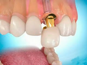 Orthodental