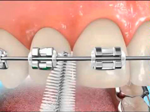 Orthodental
